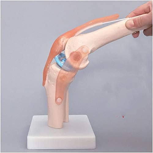 Knee joint